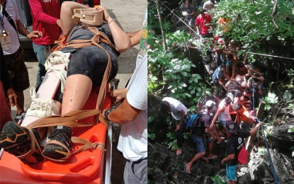<p><strong>RESCUED ON TARAW CLIFF.</strong> 24-year old Australian national Gabrielle Lauren Philips is seen with a cast on her right leg after she slipped and suffered an injury on Taraw Cliff in El Nido town, northern Palawan. The jagged cliff is a popular highland spot in the municipality that tourists love to visit to get a good view of Bacuit Bay. <em>(Photo courtesy by El Nido MDRRMO)</em></p>