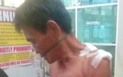 <p><strong>‘WAYWARD’ BOMB.</strong> Blast victim Ali Masla, 62, undergoes treatment at a hospital for a shoulder wound after a suspected wayward bomb projectile hit their home in Sitio Butilin, Barangay Kabasalan, Pikit, North Cotabato on Thursday (July 25, 2019). Masla’s wife, Misba, died in the incident while his 10-year-old grandson was also hurt. <em>(Photo courtesy of Jessie Ali–DXMY Cotabato)</em></p>