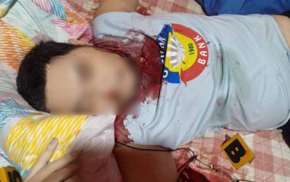 <p><strong>NPA LEADER KILLED.</strong> Ranking communist New People’s Army leader Alvin Luque, also known as Joaquin Jacinto, dies during a predawn law enforcement operation conducted by police and military personnel at a resort in Tandag City, Surigao del Sur on Thursday (Dec. 10, 2020). Luque and a still-unidentified companion, who also died, allegedly fought it off with the authorities. <em>(Photo courtesy of SDSPPO)</em></p>