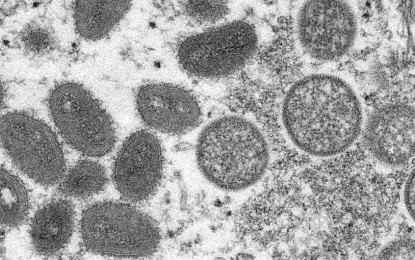 <p><strong>VIRUS</strong>. Monkeypox is a rare viral disease that usually occurs throughout Central and West Africa, often near tropical rain forests. On Friday (Aug. 26, 2022), the Department of Science and Technology said the agency is open to evaluating research and development proposals on the viral disease for possible funding. <em>(Photo courtesy of UN)</em></p>