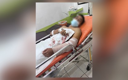 <p><strong><span data-preserver-spaces="true">WOUNDED.</span></strong><span data-preserver-spaces="true"> A soldier wounded by anti-personnel mine blast in Las Navas, Northern Samar on December 18. The six troopers were hurt while securing a water system project carried out through the national government’s Support to Barangay Development Program. </span><em><span data-preserver-spaces="true">(Photo courtesy of Philippine Army)</span></em></p>