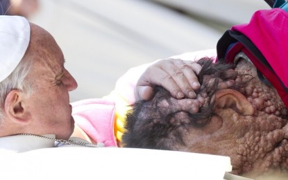 Man with deformed face who Pope hugged in 2013 dies