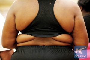 New US regulation takes on obesity, orders menus to list calories