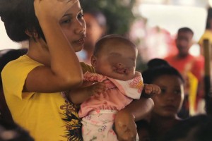  Free cleft surgery to 100 patients in Palawan
