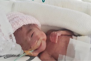 Saving Faith: The ordeal, triumphs of premature babies