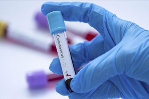 Primer on coronavirus testing