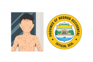 HFMD cases in Negros Occidental 'very alarming'