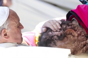 Man with deformed face who Pope hugged in 2013 dies